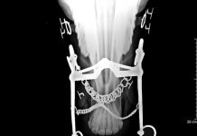 Robert Cook and Matthew Kibler: A natural experiment with 66 horses identifies 69 behaviors caused by bit-induced pain
